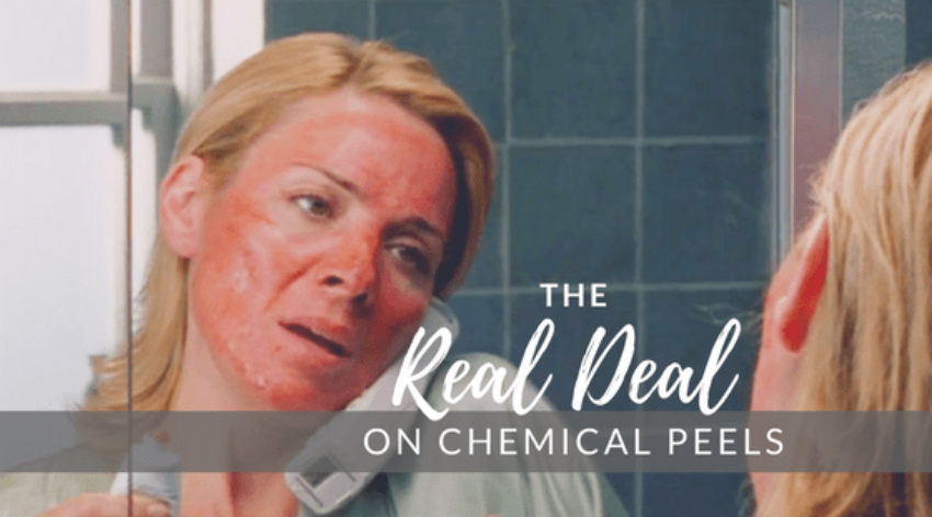 Will A Chemical Peel Make Me Look Like Samantha From Sex And The City